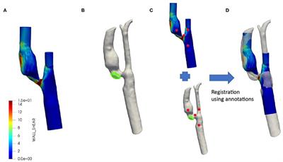 The Association Between Time-Varying Wall Shear Stress and the Development of Plaque Ulcerations in Carotid Arteries From the Plaque at Risk Study